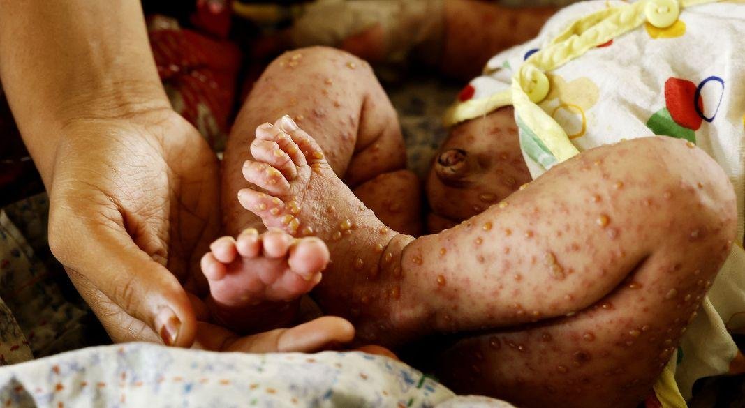 ছবি: সংগৃহীত।