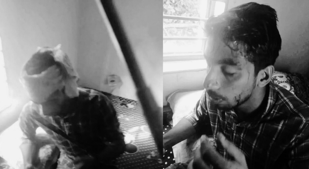 আহতরা হাসপাতালে ভর্তি