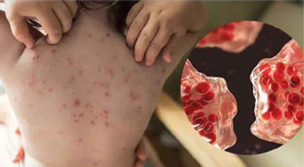 ছবি: সংগৃহীত।