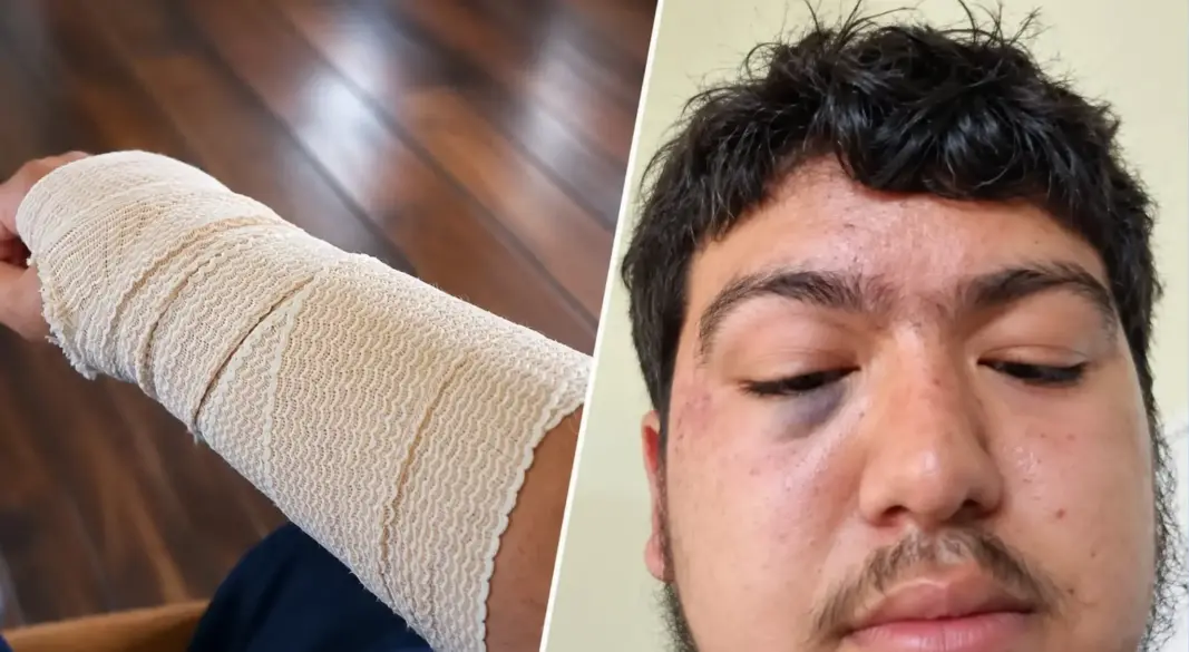 সান্তা মারিয়া শহরে স্কুলে যাওয়ার পথে বিশেষ চাহিদাসম্পন্ন ২০ বছর বয়সী এক মার্কিন নাগরিককে আটক করে ফেডারেল অভিবাসন কর্তৃপক্ষ।