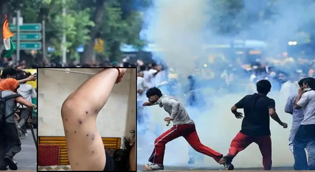 আহত সাংবাদিক
