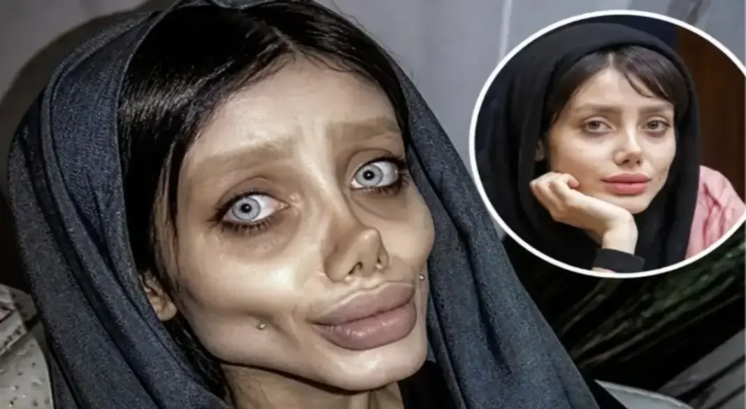 ইরানের সাহার তাবার সম্পাদিত ছবির মাধ্যমে ‘জম্বি অ্যাঞ্জেলিনা জোলি’ নামে বিশ্বজুড়ে পরিচিতি পান। গ্রাফিক্স: আমেরিকা বাংলা