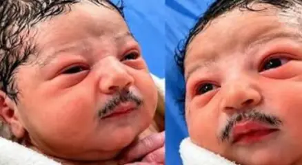 জন্মের পরই নবজাতকের মুখে ঘন কালো গোঁফ, ভাইরাল ভিডিও ঘিরে তোলপাড়