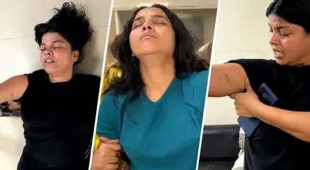 শরীরে আঘাতের চিহ্ন নিয়ে আহত নারীর ছবি সামাজিক যোগাযোগমাধ্যমে ছড়িয়ে পড়েছে